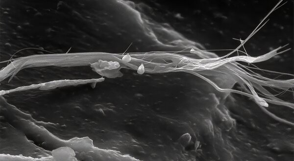 Immagine al microscopio elettronico a scansione (SEM) di una fibra di amianto; un esempio di prove interlaboratorio come misura di controllo della qualità | © CRB Analyse Service GmbH